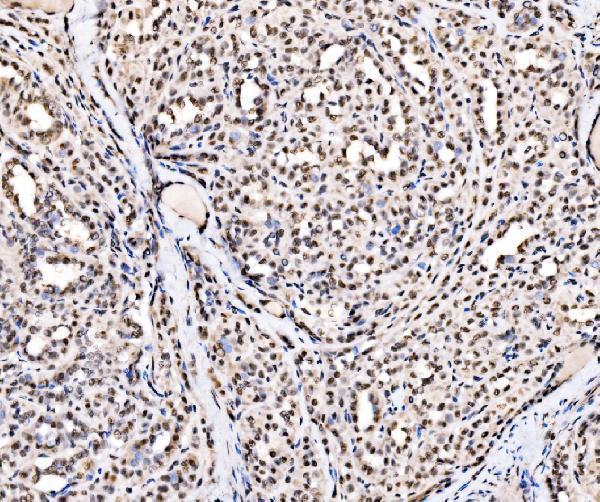 a00705 1 ssb primary antibodies ihc testing 5