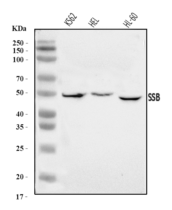  Western blot analysis of SSB using anti-SSB antibody (A00705-1)