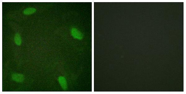 a00705s366 1 ssb primary antibodies if testing 1