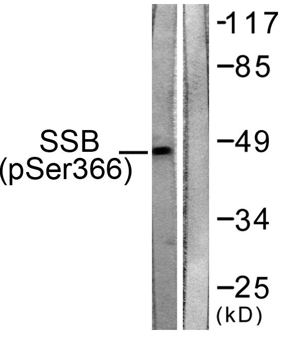 Western blot analysis of lysates from 293 cells, using SSB (Phospho-Ser366) Antibody