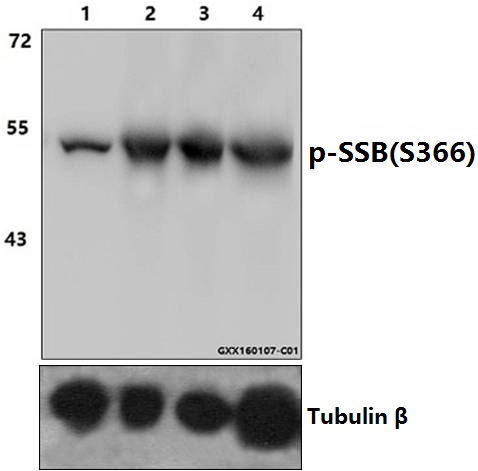 Western blot (WB) analysis of p-SSB (S366) polyclonal antibody at 1:1000 dilution
Lane1:HEK293T whole cell lysate
Lane2:HEK293T treated with EGF(0