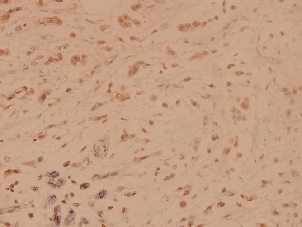 a00705t362 1 ssb primary antiboties ihc testing 2