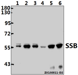 a00705t362 1 ssb primary antiboties wb testing 1