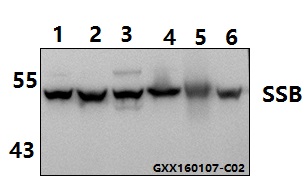 a00705t362 ssb primary antiboties wb testing 1