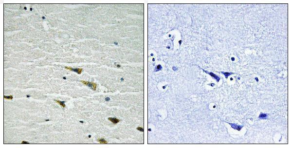 Immunohistochemistry analysis of paraffin-embedded human brain, using Trk A (Phospho-Tyr757) Antibody