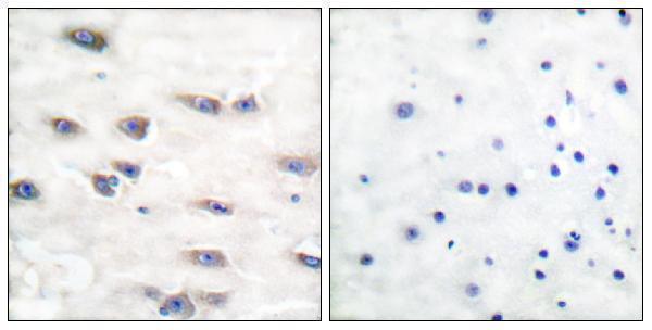 Immunohistochemistry analysis of paraffin-embedded human brain, using Trk A (Phospho-Tyr791) Antibody