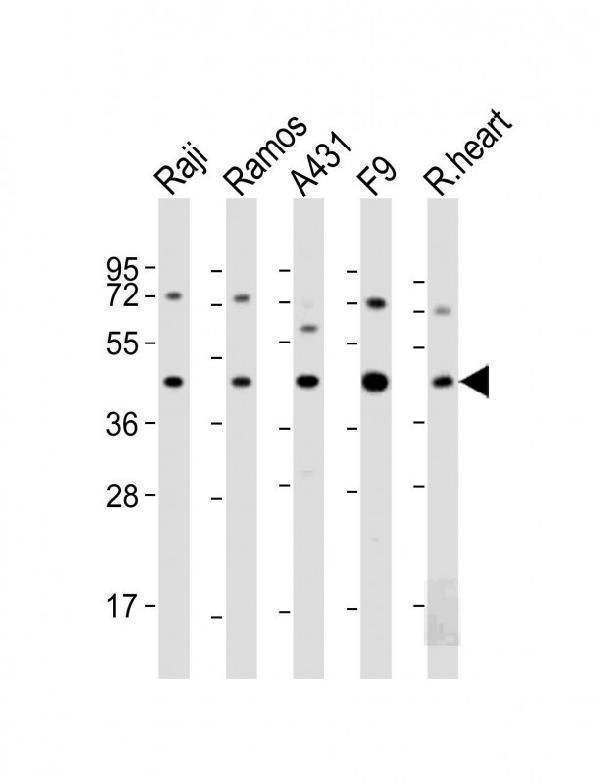 All lanes : Anti-MCL1 Antibody (BH3 Domain Specific) at 1:2000 dilutionLane 1: Raji whole cell lysateLane 2: Ramos whole cell lysateLane 3: A431 whole cell lysateLane 4: F9 whole cell lysateLane 5: A20 whole cell lysateLysates/proteins at 20 µg per lane