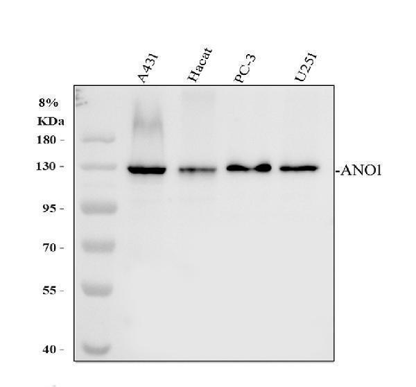 Western blot analysis of TMEM16A using anti-TMEM16A antibody (A00713)