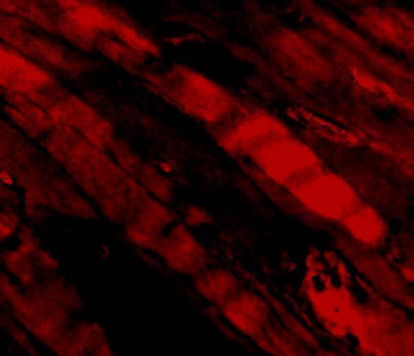 Immunofluorescence of Emerin in Human Skeletal Muscle cells with Emerin antibody at 5 μg/mL