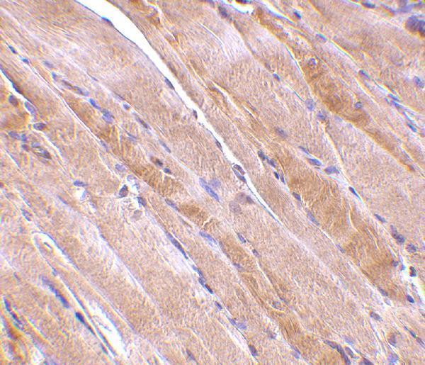 Immunohistochemistry of emerin in human skeletal muscle tissue with emerin antibody at 2