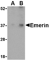 Western blot analysis of Emerin in human skeletal muscle tissue lysate with Emerin antibody at (A) 0