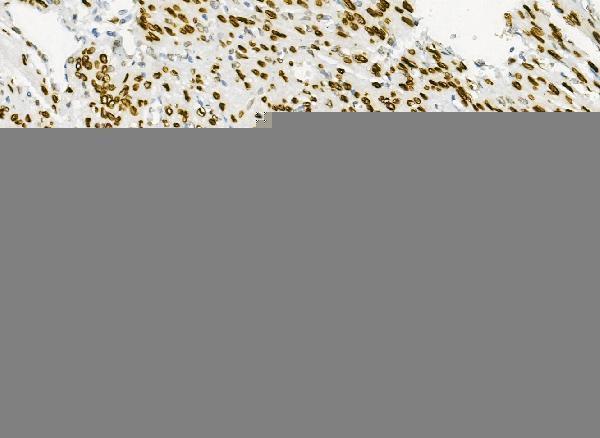  IHC analysis of Emerin using anti-Emerin antibody (A00714)