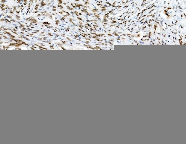  IHC analysis of Emerin using anti-Emerin antibody (A00714)