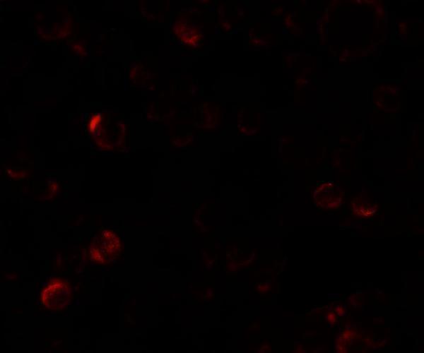 a00715 epm2a primary antibodies if testing 3