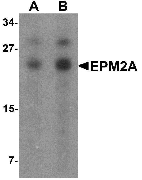 a00715 epm2a primary antibodies wb testing 1