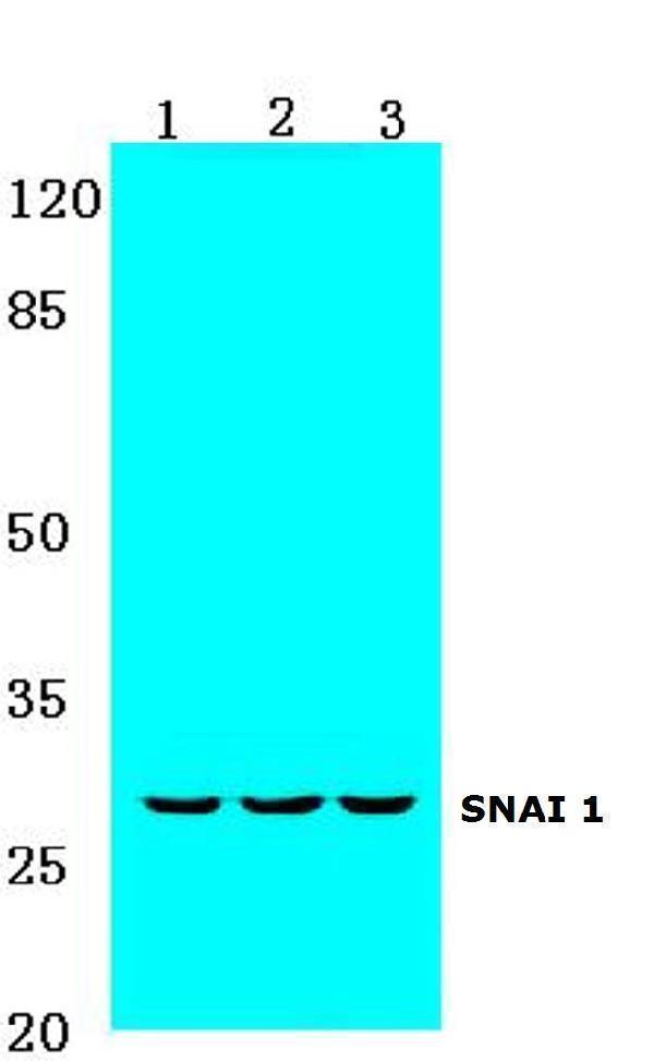 Western blot (WB) analysis of Snail1 (A242) polyclonal antibody at 1:500 dilution
Lane1:MCF-7 cell lysate
Lane2:NIH-3T3 cell lysate
Lane3:Rat heart tissue lysate