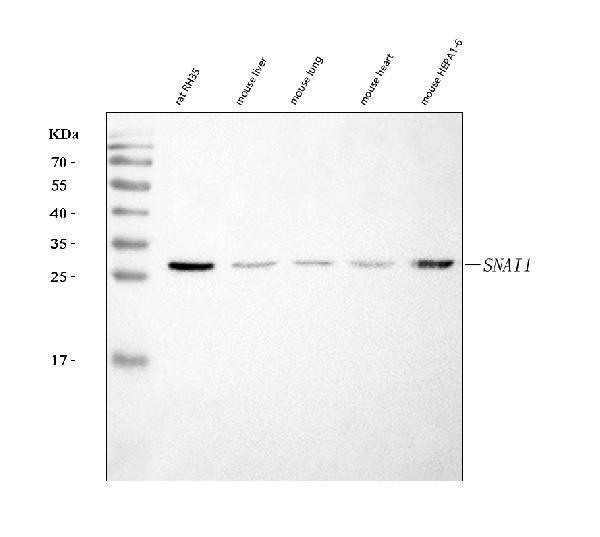  Western blot analysis of SNAIL/SNAI1 using anti-SNAIL/SNAI1 antibody (A00716-2)