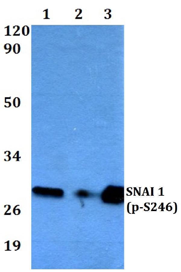 Western blot (WB) analysis of Snail1 (phospho-S246) polyclonal antibody at 1:500 dilution
Lane1:MCF-7 whole cell lysate
Lane2:Raw264