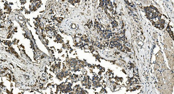 a00718 1 flcn primary antibodies ihc testing 5