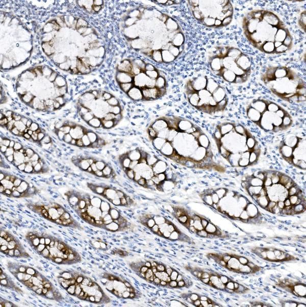  IHC analysis of MUC5B using anti-MUC5B antibody (A00719-2)
