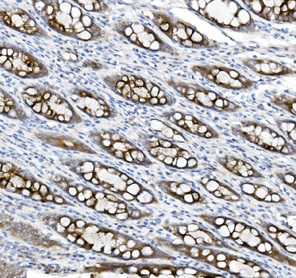  IHC analysis of MUC5B using anti-MUC5B antibody (A00719-2)