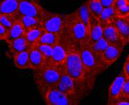 ICC staining alpha 1 Antitrypsin in Hela cells (red)