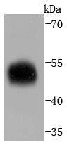 Western blot analysis of alpha 1 Antitrypsin on human spleen lysates using anti-alpha 1 Antitrypsin antibody at 1/1,000 dilution