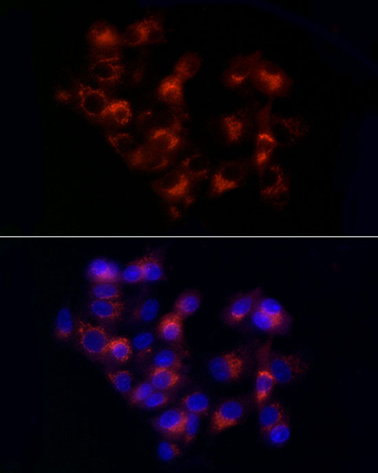Immunofluorescence analysis of HepG2 cells using Alpha-1 Antitrypsin  Rabbit pAb  at dilution of 1:50 
