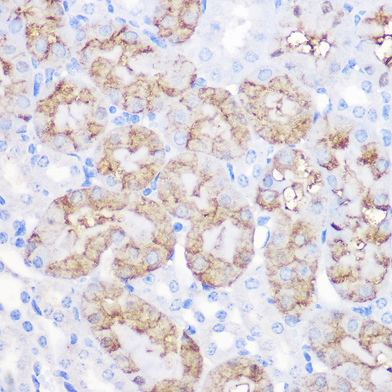 Immunohistochemistry of paraffin-embedded mouse kidney using Alpha-1 Antitrypsin ) Rabbit pAb  at dilution of 1:100 