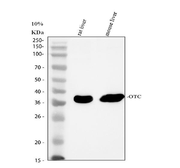 Western blot analysis of OTC using anti-OTC antibody (A00721-1)