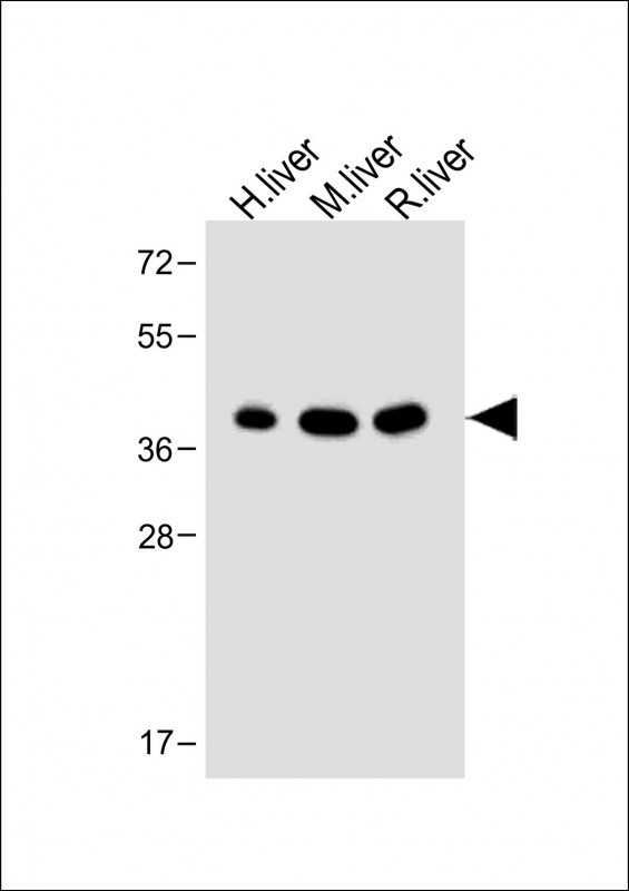 All lanes : Anti-OTC Antibody (Center) at 1:2000 dilutionLane 1: Human liver lysateLane 2: Mouse liver lysateLane 3: Rat liver lysateLysates/proteins at 20 µg per lane