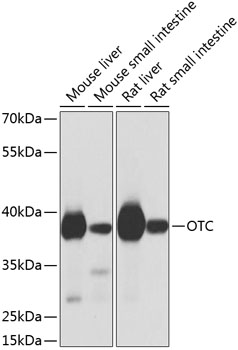 Western blot analysis of extracts of various cell lines, using OTC antibody  at 1:1000 dilution