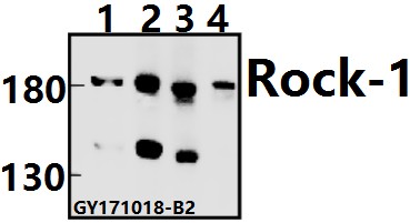 Western blot (WB) analysis of Rock-1 (N311) pAb at 1:500 dilution
Lane1:HCT116 whole cell lysate(40ug)
Lane2:HEK293T whole cell lysate(40ug)
Lane3:CT26 whole cell lysate(40ug)
Lane4:PMVEC whole cell lysate(40ug)
