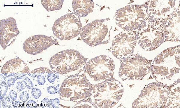 a00722 3 rock1 primary antibodyes ihc testing 10
