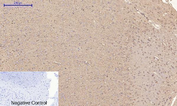 a00722 3 rock1 primary antibodyes ihc testing 11