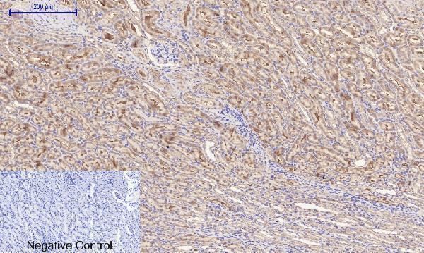 a00722 3 rock1 primary antibodyes ihc testing 13