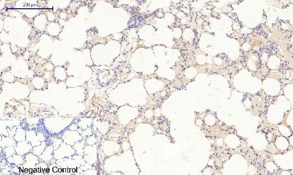 a00722 3 rock1 primary antibodyes ihc testing 14