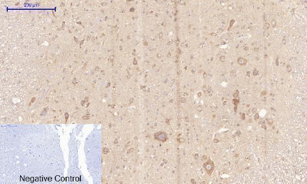 a00722 3 rock1 primary antibodyes ihc testing 15