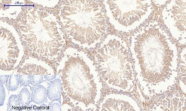 a00722 3 rock1 primary antibodyes ihc testing 17