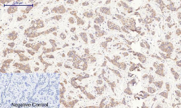 a00722 3 rock1 primary antibodyes ihc testing 2