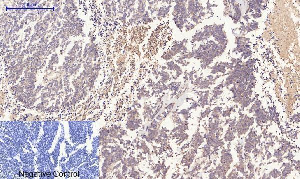 a00722 3 rock1 primary antibodyes ihc testing 3