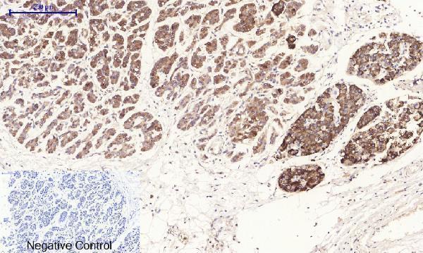 a00722 3 rock1 primary antibodyes ihc testing 4