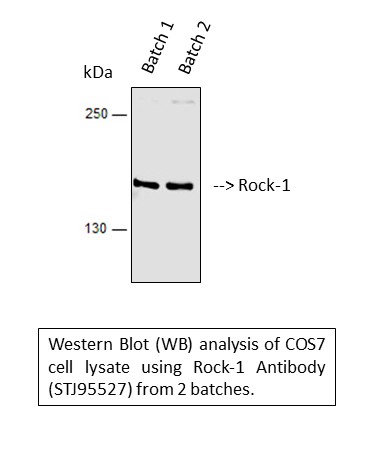 a00722 3 rock1 primary antibodyes wb testing 1