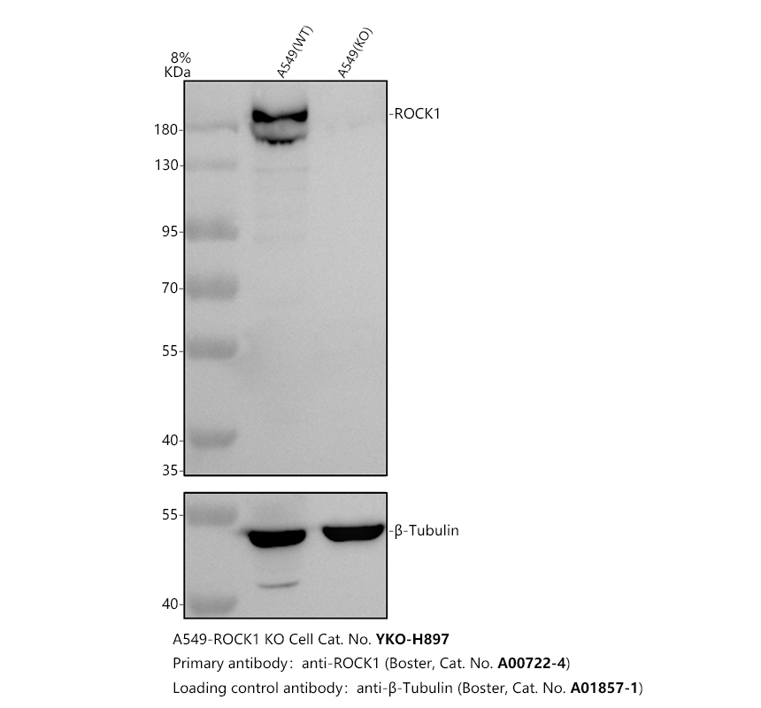 Western blot analysis of ROCK1 using anti-ROCK1 antibody (A00722-4)