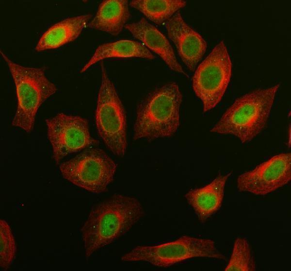 a00722 5 rock1 primary antibodies if testing 1