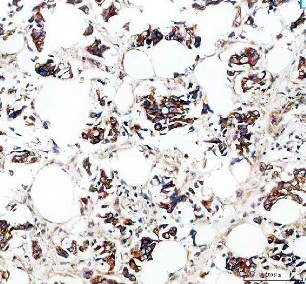 IHC analysis of ROCK1 using anti-ROCK1 antibody (A00722-5)