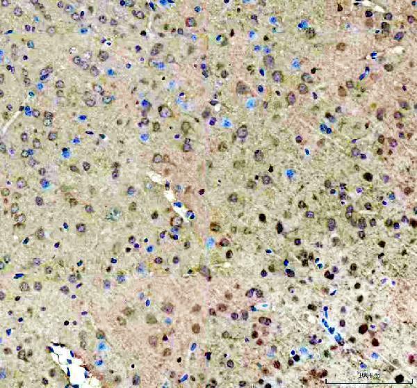 IHC analysis of ROCK1 using anti-ROCK1 antibody (A00722-5)