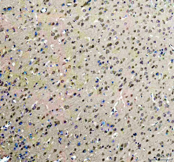a00722 5 rock1 primary antibodies ihc testing 3