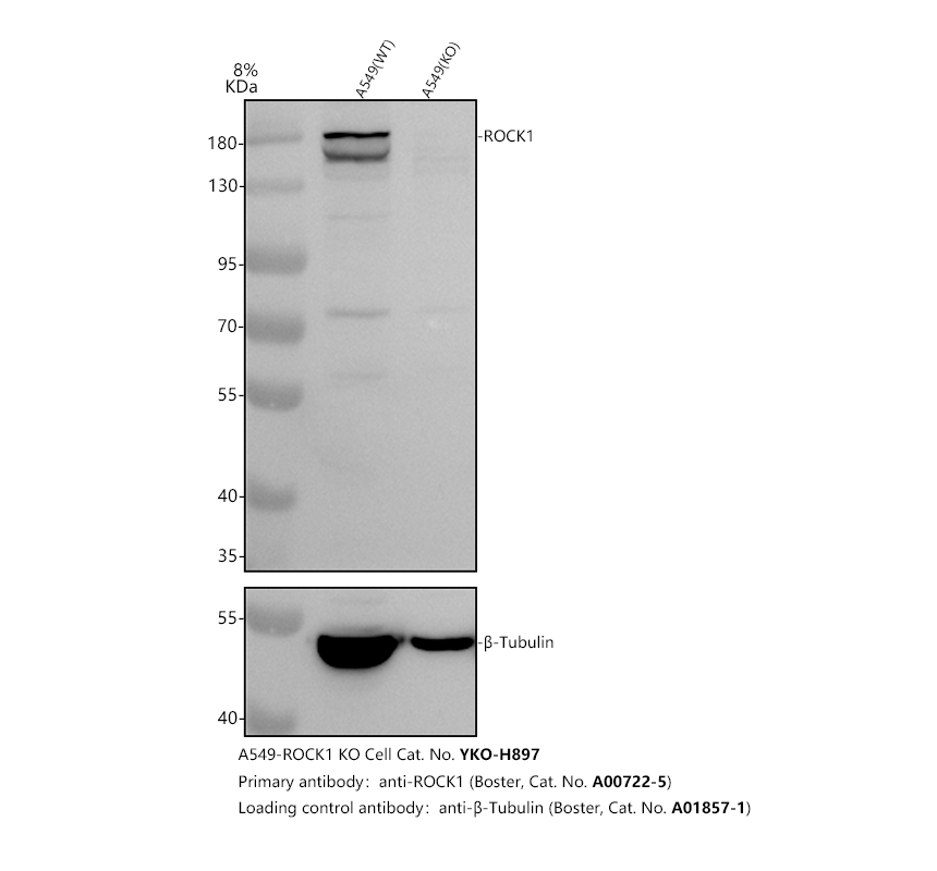 a00722 5 rock1 primary antibodies wb testing 2