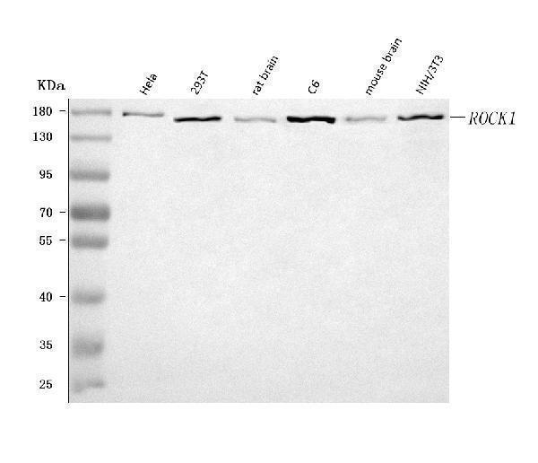 A00722-6 · ROCK1 — observed 158.2 kDa WB validation